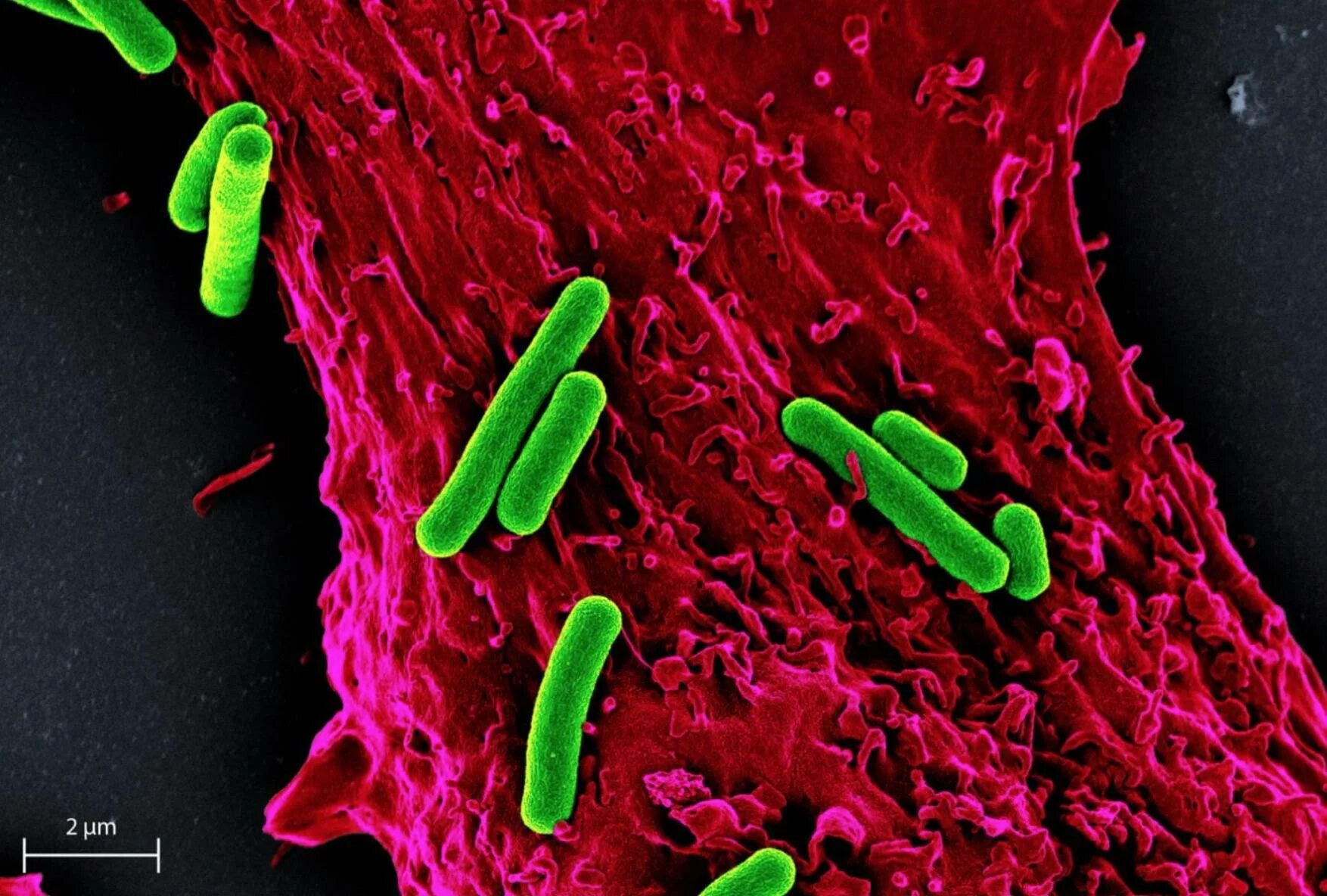 Рубцовые бактерии. Микроорганизмы цианобактерии. Зеленые серные бактерии. Фотосинтезирующие бактерии. Силикатные бактерии.