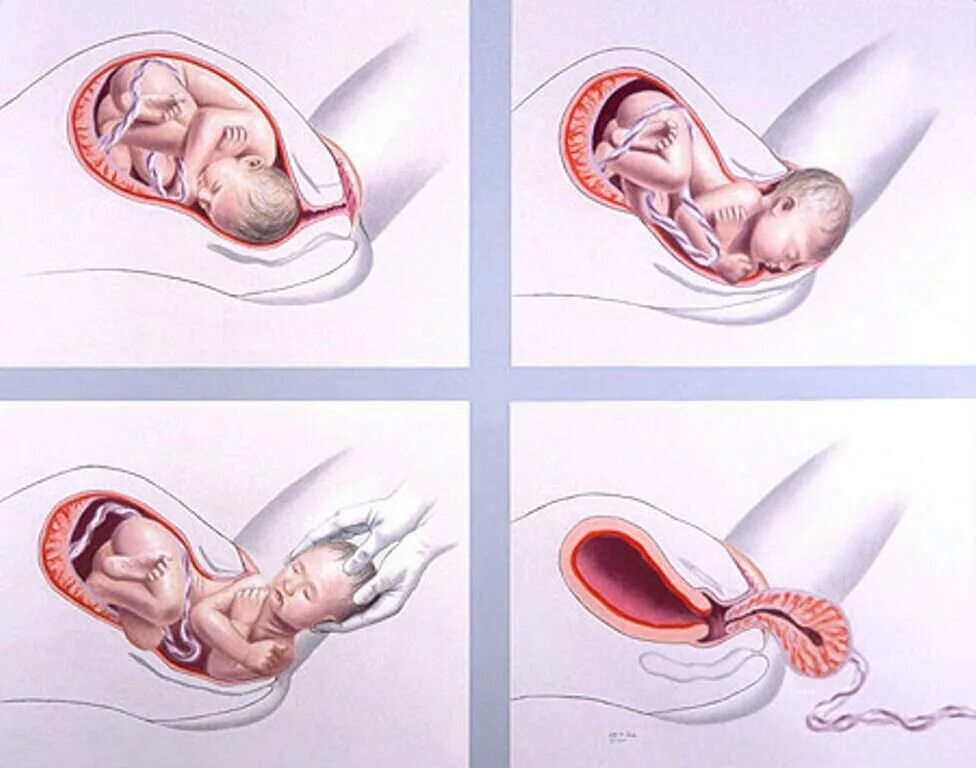 Процесрожденияребенка. Рождение ребенка поэтапно.