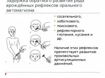 Признаки дцп у новорожденного в 1