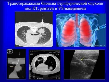 Легкие поды