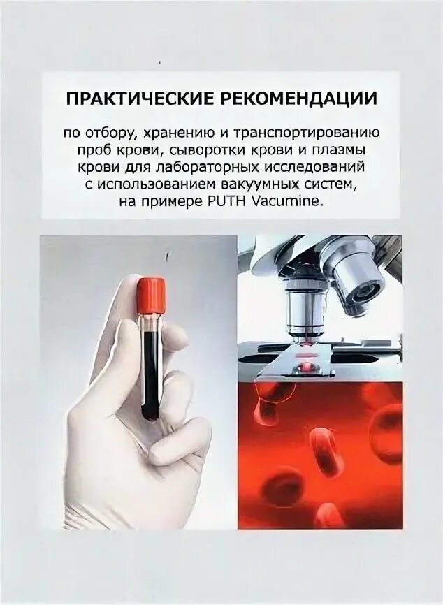 Проба сыворотки. Хранения проб сыворотки крови. хранение крови для лабораторных исследований. отбор крови для лабораторного исследования.. отбор проб для лабораторных исследований крови.
