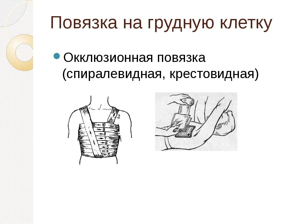 Повязка на грудную клетку алгоритм. Техника наложения окклюзионной повязки. Показания для окклюзионной повязки. Окклюзионная повязка при пневмотораксе. Показания для наложения окклюзионной повязки.