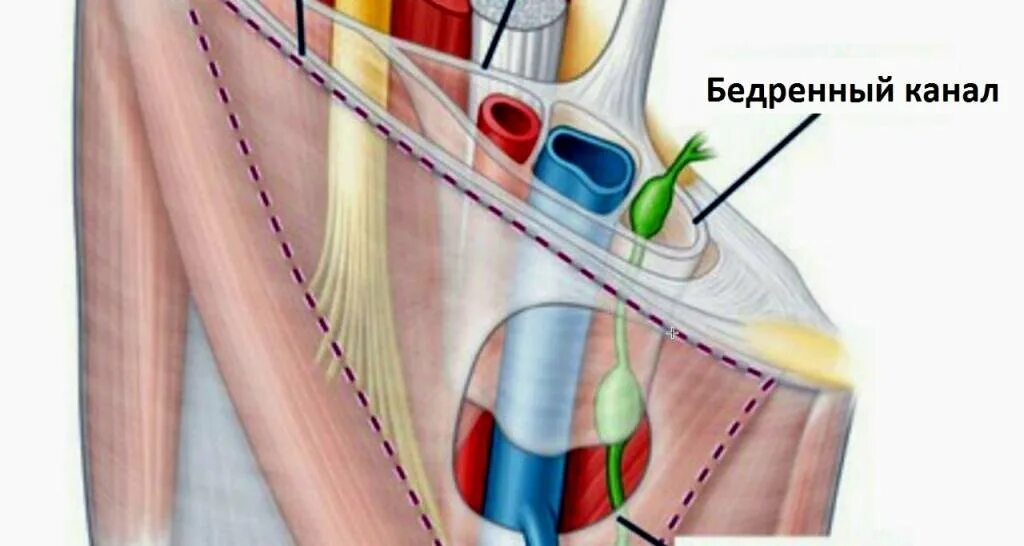 Бедренный треугольник топография. Стенки бедренного канала топографическая анатомия. canalis femoralis топография. бедренный треугольник анатомия. бедренный канал анатомия топография.