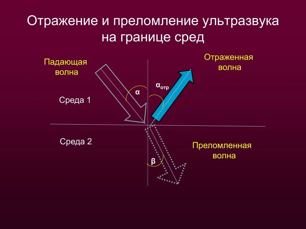 Отражение и преломление ультразвуковых волн. Отражение и преломление ультразвука на границе сред.. Отражение ультразвука. Отражение ультразвука на границе двух сред.