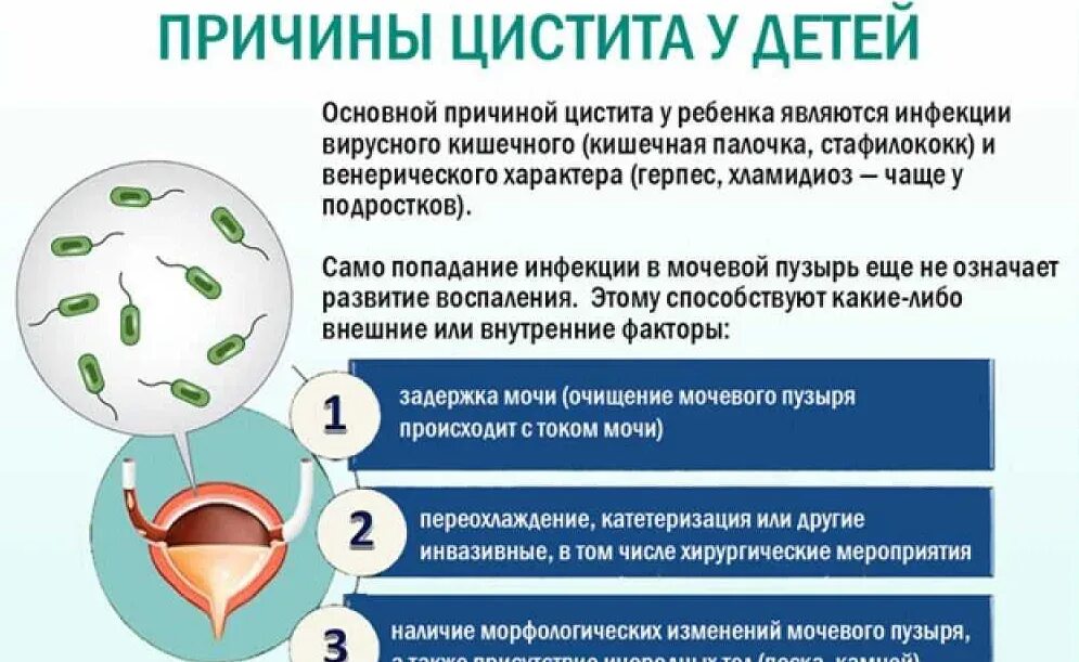 Синдром раздраженного мочевого пузыря
