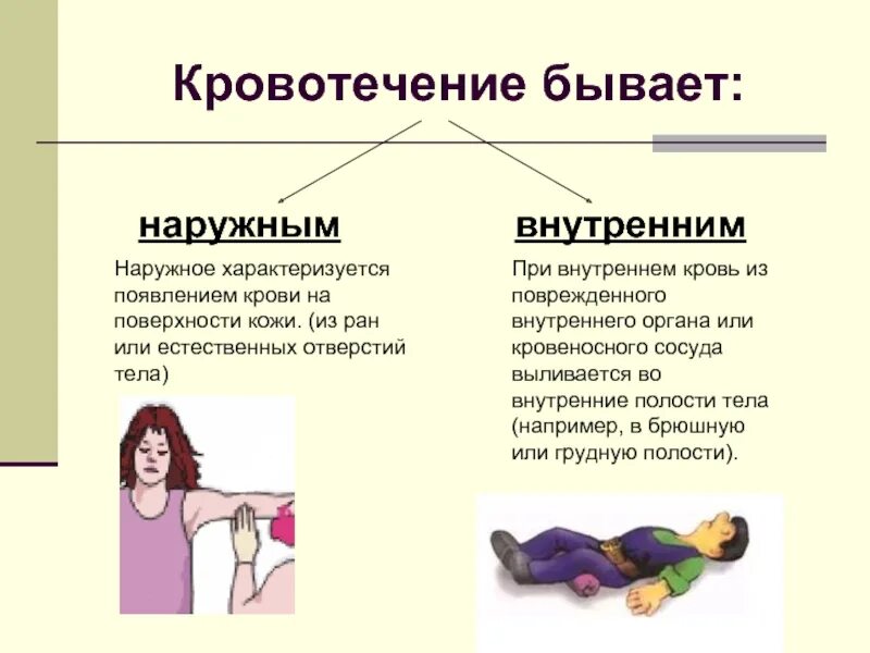 Признаки внутреннего кровотечения оказание помощи. Типы внешних кровотечений. Виды кровотечения внутренние и внешние. Отличие внутреннего и внешнего кровотечения. Внутреннее и внешнее кровотечение.