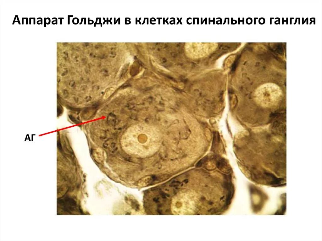 Клетки спинномозгового узла. Аппарат Гольджи в клетках спинального ганглия. Пластинчатый комплекс Гольджи в клетках спинального ганглия. Комплекс Гольджи в нейронах спинального ганглия. Пластинчатый комплекс Гольджи в клетках спинномозгового узла.