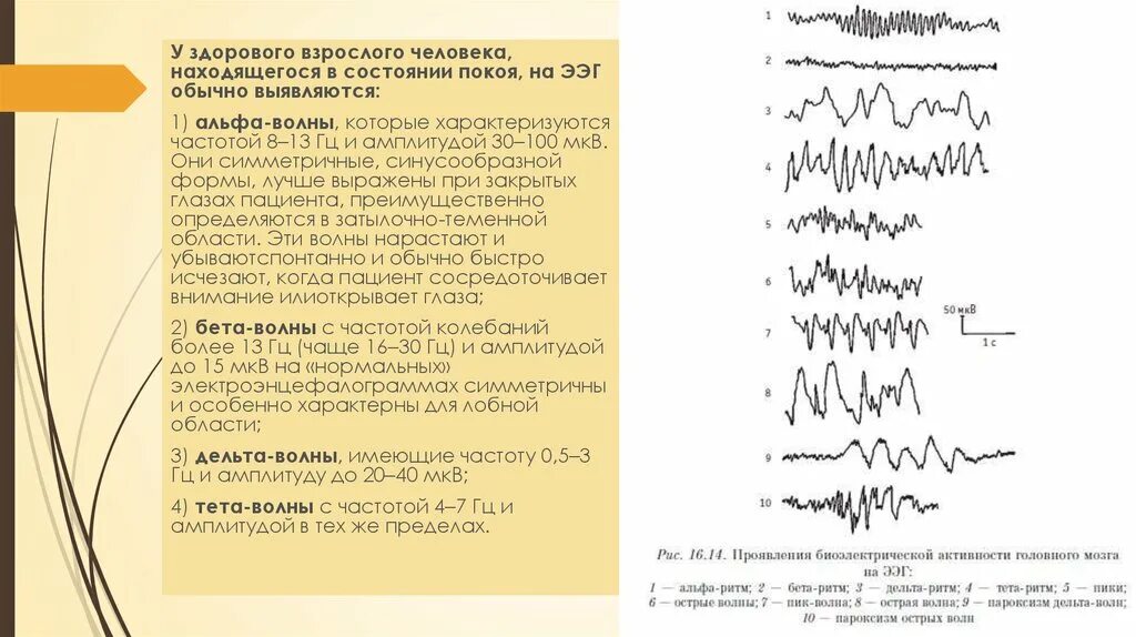 Что значит эпилептиформная активность. Эпилептиформные паттерны на ЭЭГ. Эпилептиформная активность на ЭЭГ. ЭЭГ при эпилепсии. Эпилептиформные феномены на ЭЭГ что это.
