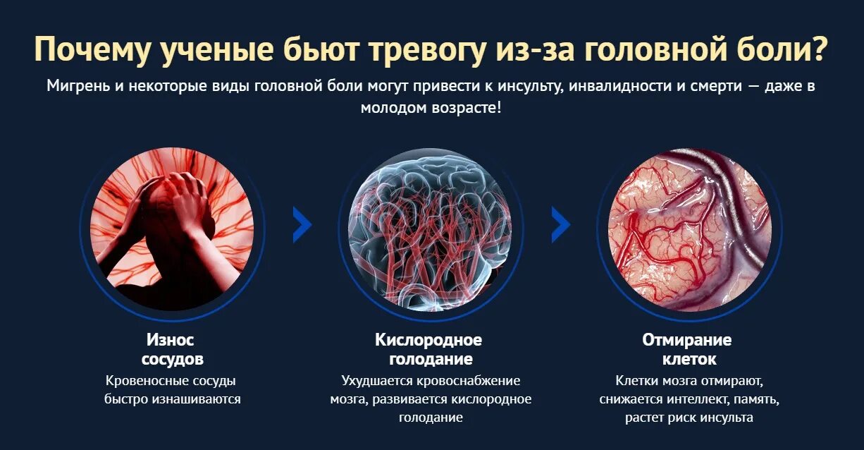 Что происходит при мигрени. Головная боль мигрень. Мигренозные головные боли. Осложнения головной боли. Мигрень механизм возникновения.