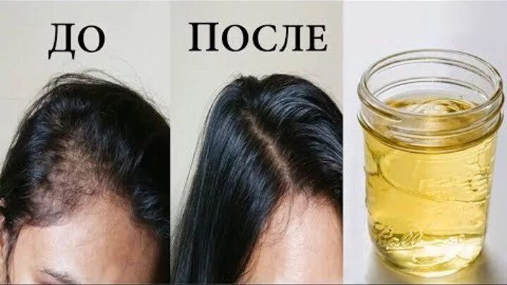 Помогает Ли Сперма В Росте Волос