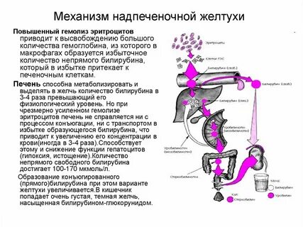 Гемолитический билирубин