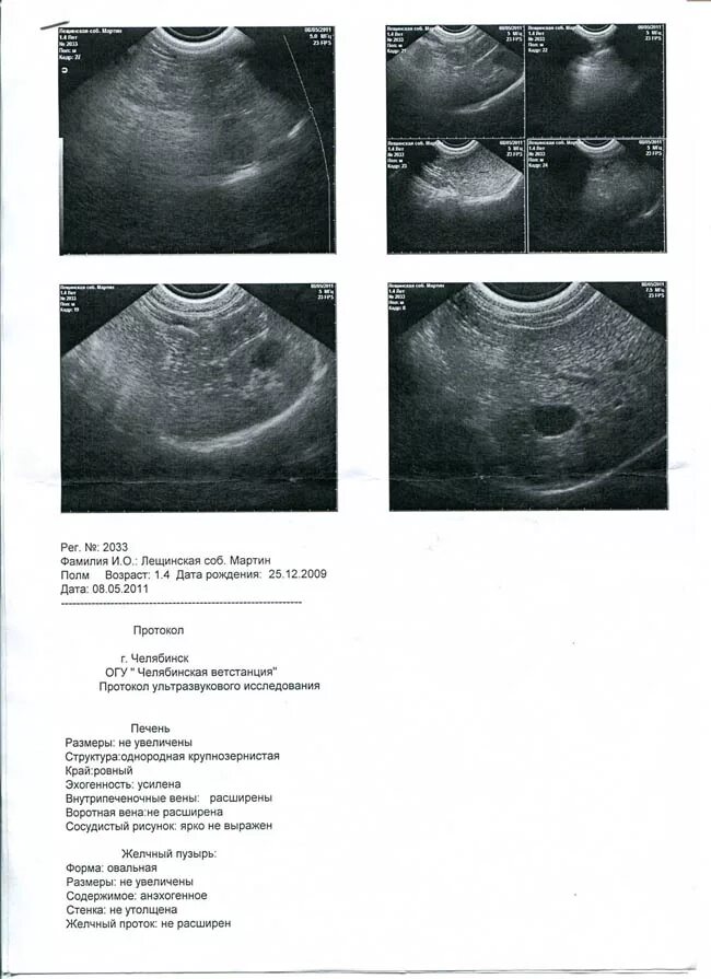 Результаты ультразвукового исследования брюшной полости. УЗИ брюшной полости расшифровка. УЗИ абдоминальное результат.