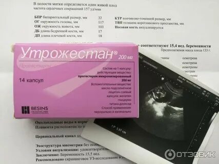 Выкидыш при утрожестане при беременности