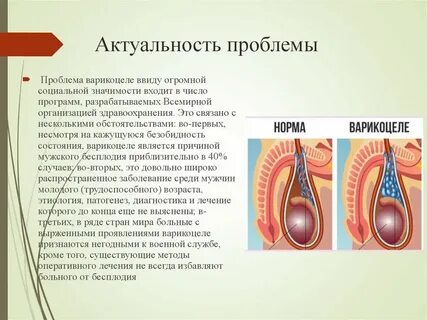 Варикацель