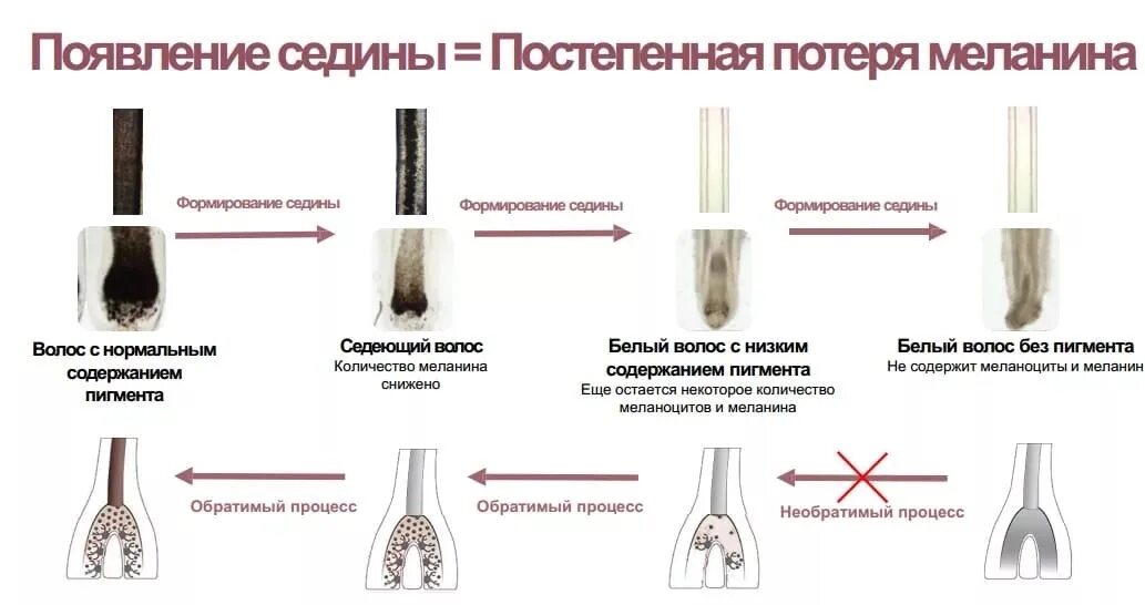 Разрушение пигментов