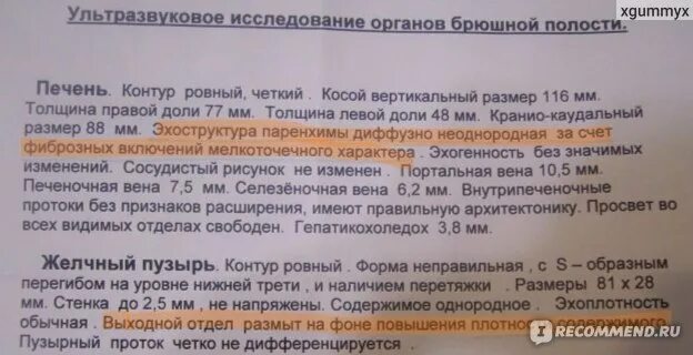 Кардиомагнил лучше пить утром или вечером. Кардиомагнил на ночь или утром. Кардиомагнил утром или вечером. В какое время суток нужно пить Кардиомагнил. Нужно ли делать перерыв при приеме кардиомагнила.