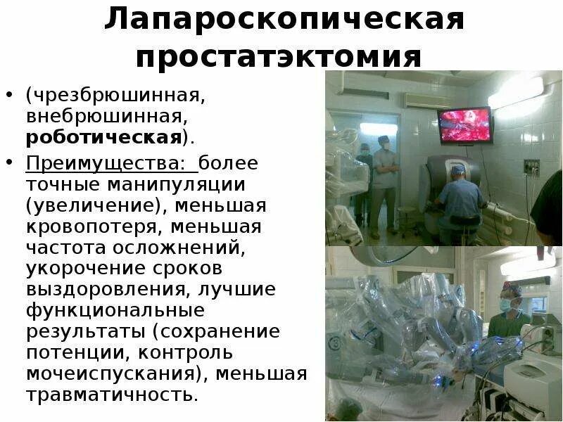 Роботическая радикальная простатэктомия. Радикальная простатэктомия этапы операции.