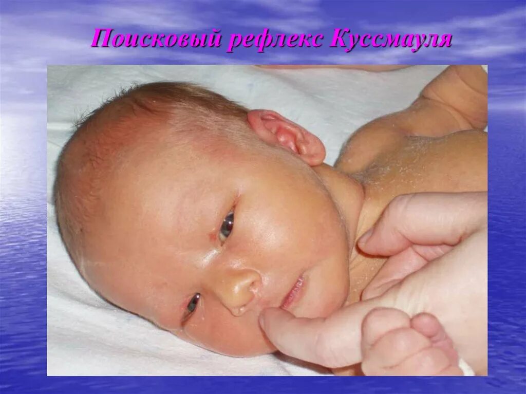 Хоботковый рефлекс. Поисковый рефлекс Куссмауля у новорожденных. Сосательный рефлекс, хоботковый рефлекс. Хоботковый рефлекс у новорожденных.