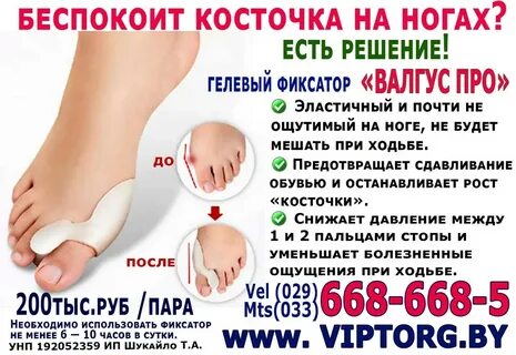 Почему растет косточка на большом пальце