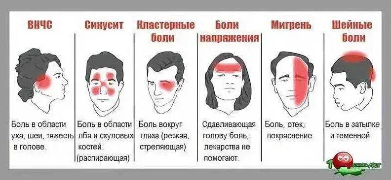 Боль в лобной части головы. Причины головной боли схема. Болит голова в лобной части. Головные боли в лобной части причины