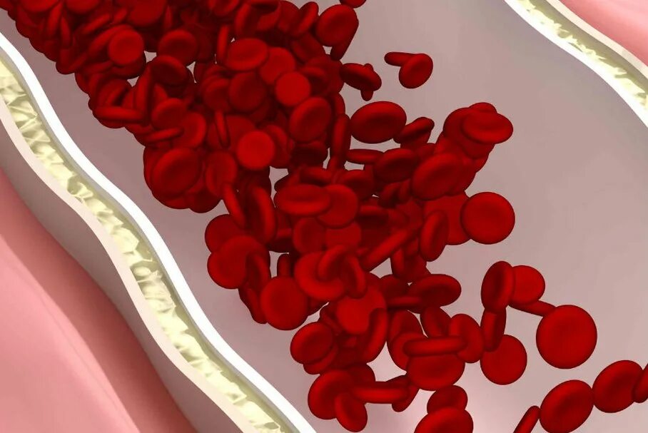 Снижение гемоглобина. Гемоглобин в крови. ДЕМОГОБЛИН. Что такое гемоглобин у человека. Гемоглобин картинки.