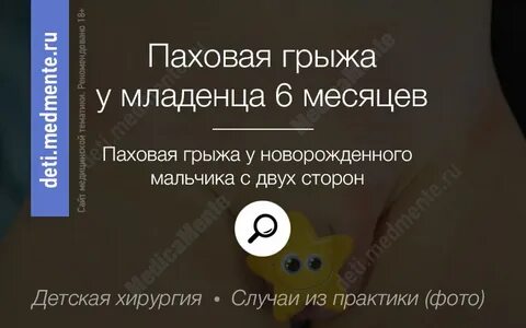 Паховая грыжа у новорожденных мальчиков