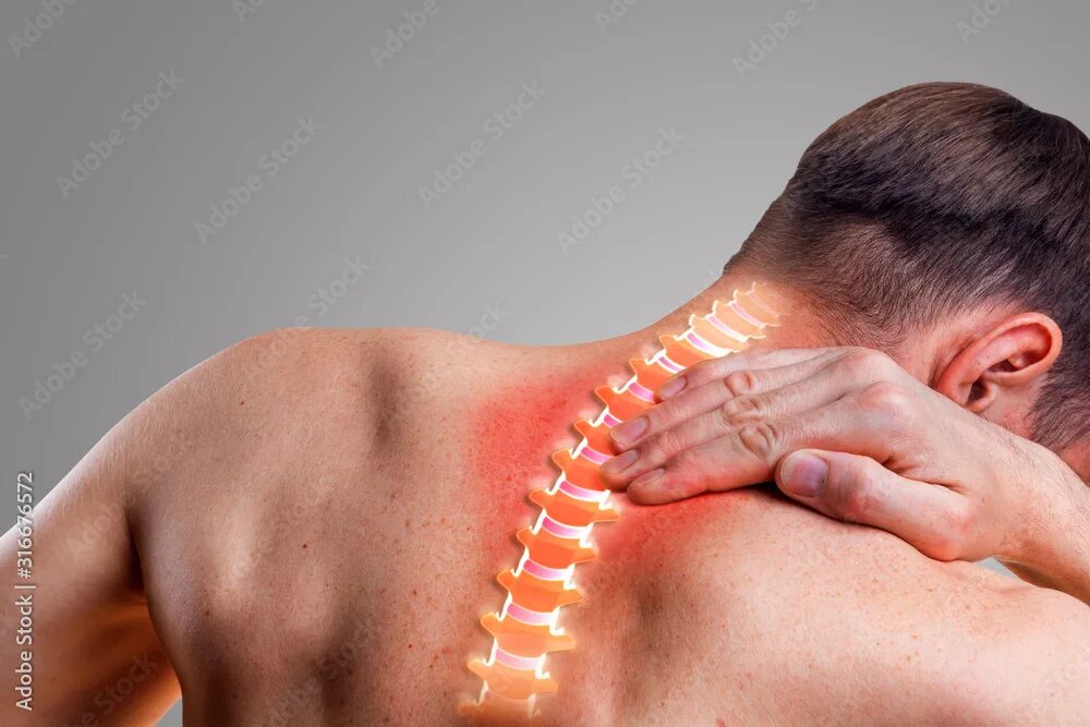 Pain in the Cervical Spine. Symptom of Cervical Chondrosis Stock Image - Image o