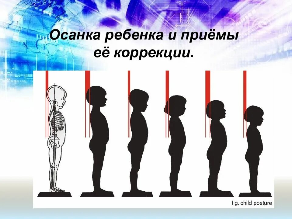 Формирование правильной осанки у детей дошкольного возраста. Правильная осанка. правильная осанка у детей. формирование правильной осанки. правильная осанка дошкольника.