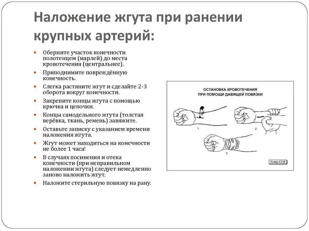 Время наложение жгута при ранении. Наложение жгута при ранении артерии. наложение жгута при ранении сонной артерии. наложение жгута при ранении крупных артерий.
