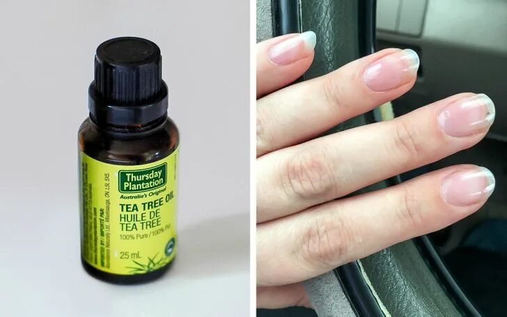 масло чайного дерева от онихолизиса ногтей. масло для кутикулы леврана. чайное дерево для ногтей при онихолизисе. препараты от онихолизиса ногтей. чайное дерево для ногтей при онихолизисе.