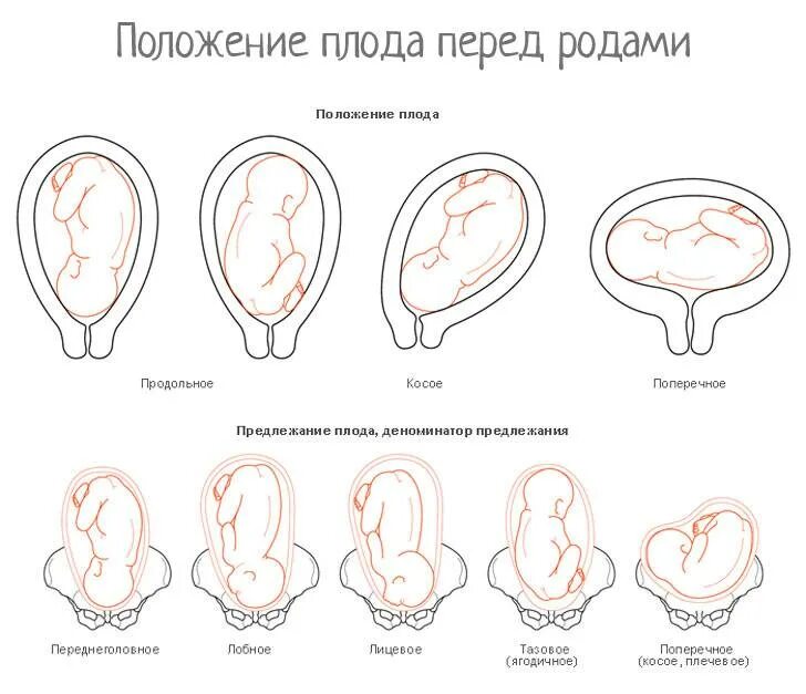Снижение веса перед родами. Тренировочная схватка. Дети затихают перед родами форум. Схема схваток при родах. Перед родами ребёнок затихает или шевелится активно.