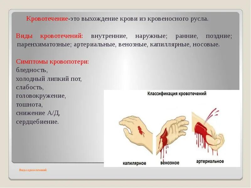 Наружные и внутренние кровотечения. Наружное и внутреннее кровотечение. Артериальное кровотечение и венозном кровотечении.