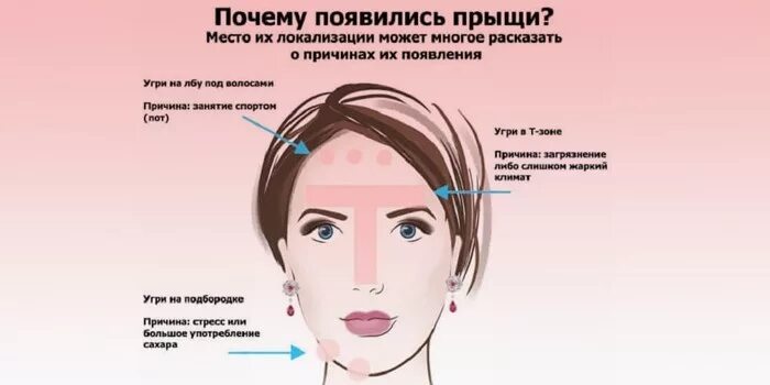 На подбородке прыщи что значит у женщин. Психосоматика прыщи на лице. прыщи на подбородке у женщин причины. прыщи на подбородке психосоматика. прыщи на лбу психосоматика.