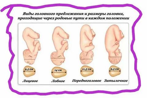 Головное переднее