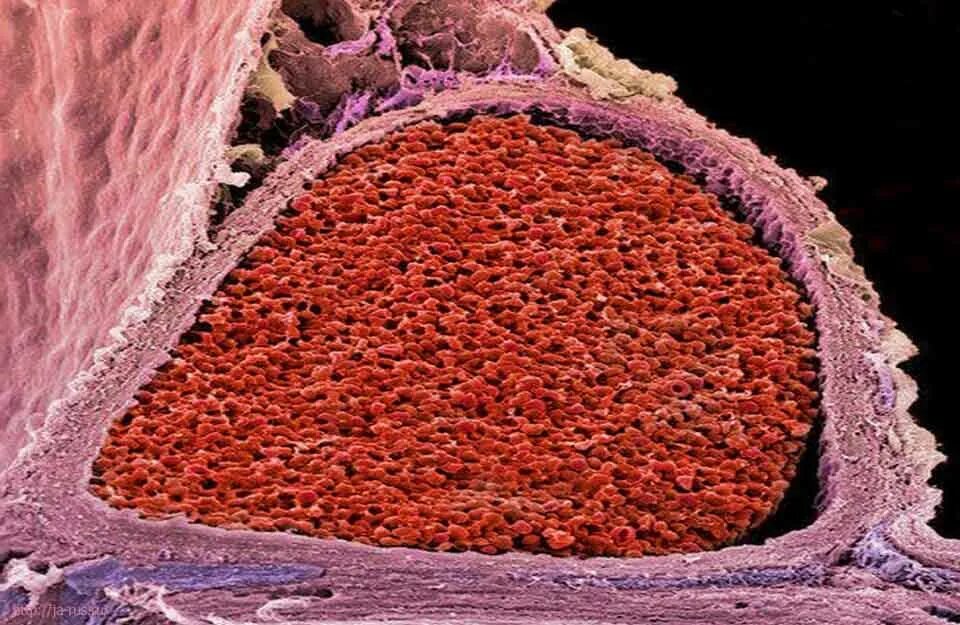влияние алкоголя на кровеносную систему человека. влияние алкоголя на сердечно-сосудистую систему. влияние спирта на эритроциты. алкоголь и сердечно сосудистая система. сосуды пьющего человека.