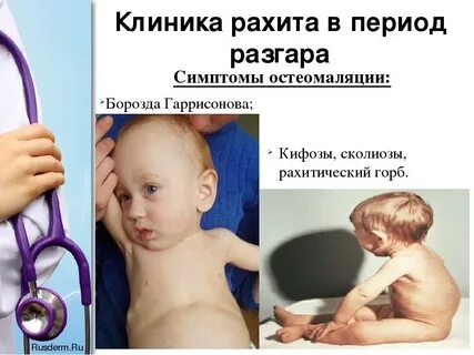 Симптом четок
