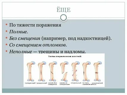Переломы презентация