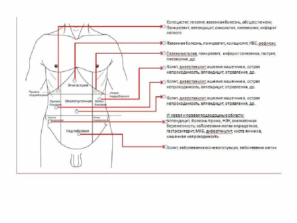 Как определить аппендицит у взрослого мужчины. Локализация боли при аппендиците. Острый аппендицит локализация боли. Острый живот мкб.