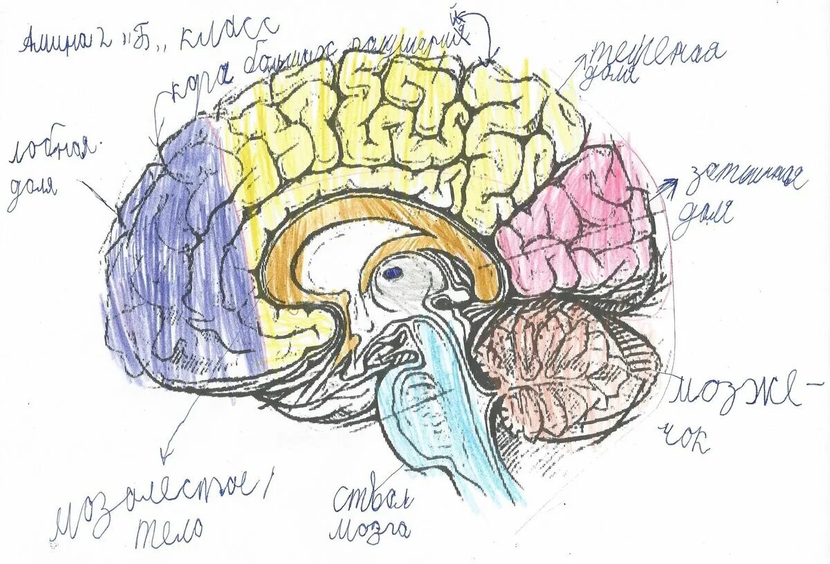 Недоразвитие зон мозга. Мозг при дислексии. Дислексия зоны мозга. Мозг умственно отсталого ребенка. Мозг умственного отсталого человека.