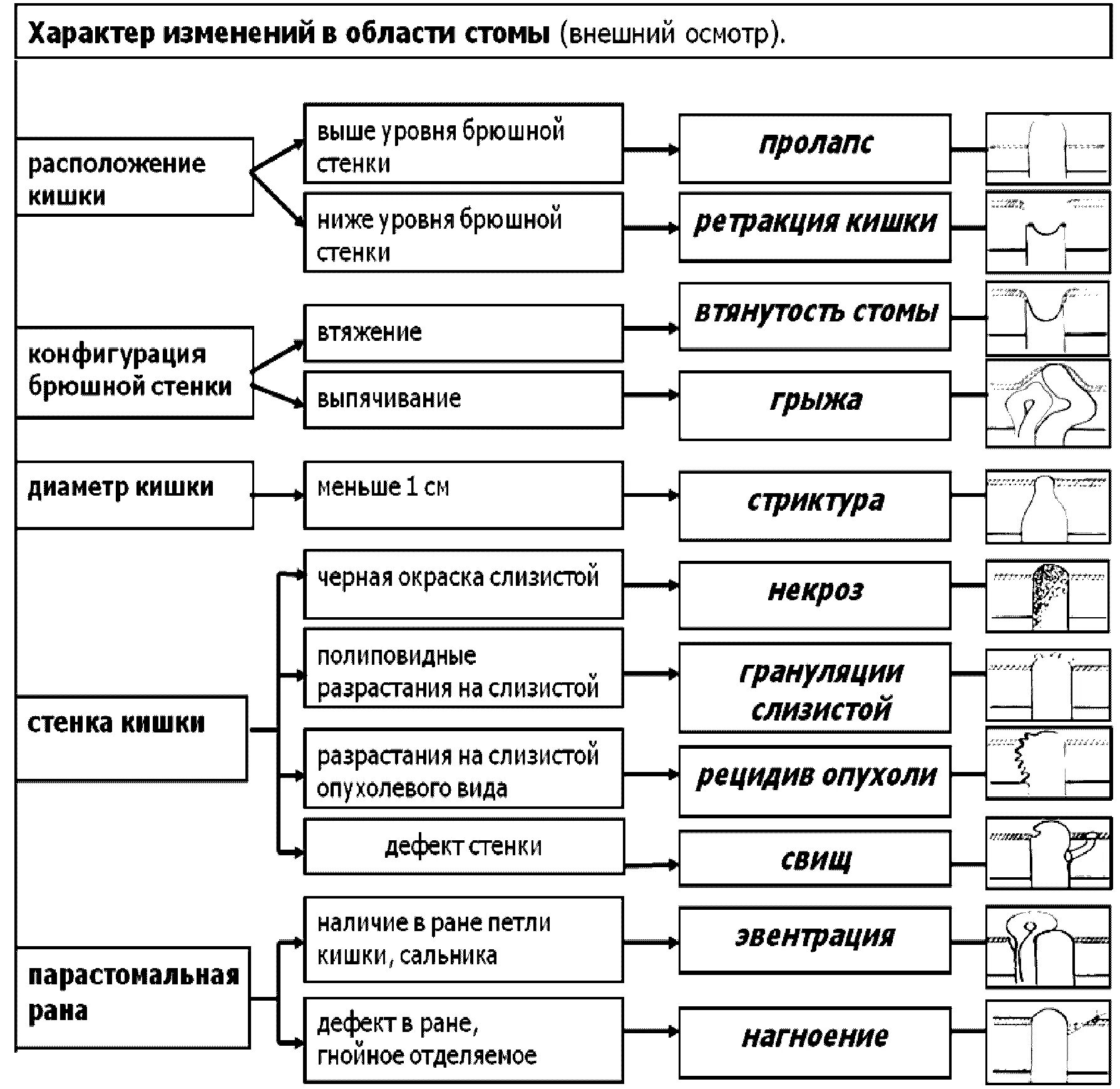 Классификация кишечных стом. Виды стом таблица. Классификация видов стом. Стома классификация. Оценка характера изменений
