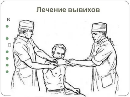 Вправление вывиха