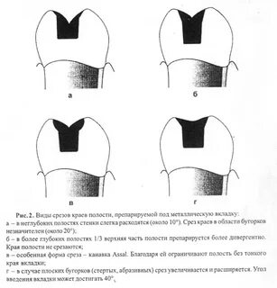 Формы срезов