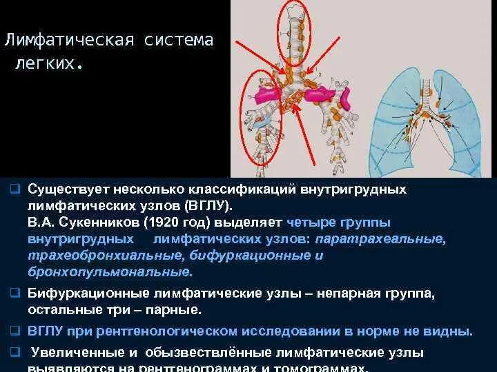 Узлы в легких что это. Паратрахеальные лимфоузлы кт. Бронхопульмональные лимфатические узлы норма. Группы внутригрудных лимфатических узлов. Анатомия внутригрудных лимфатических узлов.