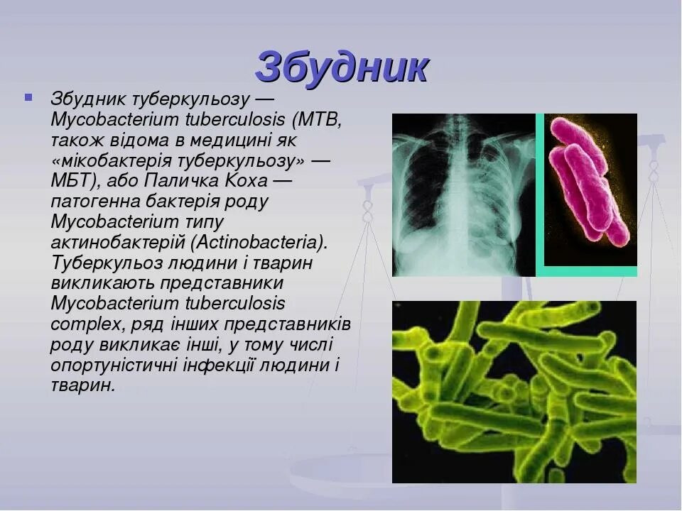 Палочка коха заболевание. Микобактерия палочки Коха. Туберкулеза бациллы Коха. Палочка Коха Mycobacterium tuberculosis. Палочка Коха Тип дыхания.