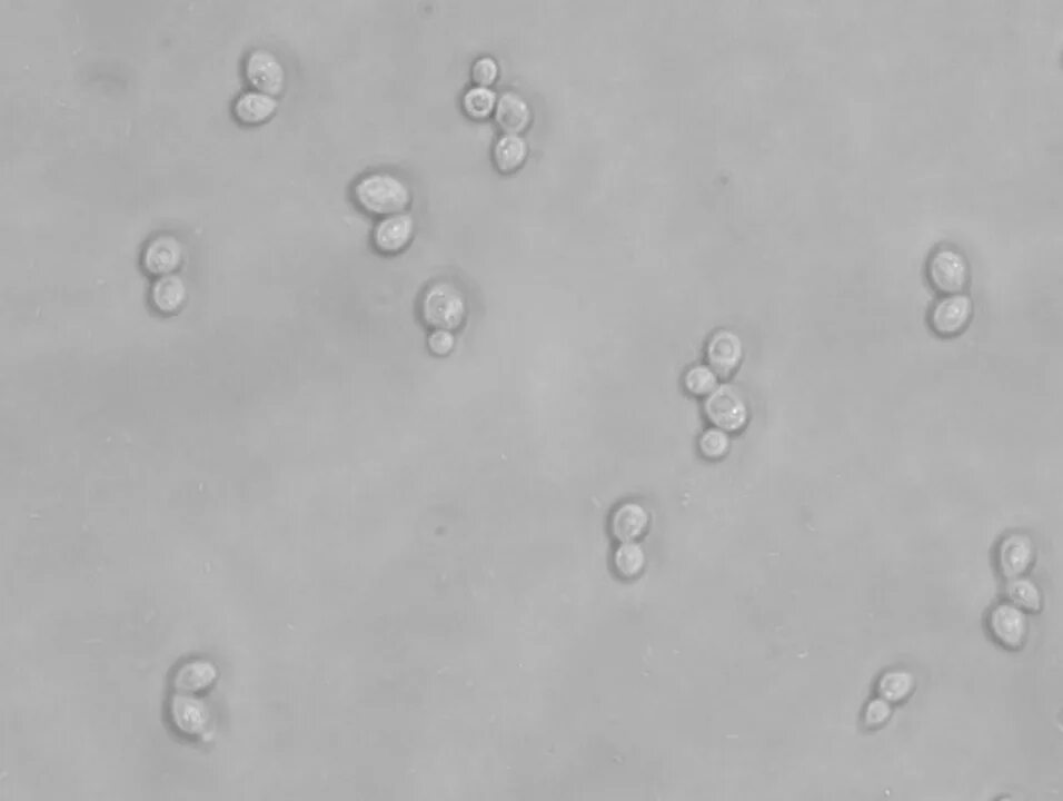 Дрожжевые клетки в моче повышены. Микроскопирование Saccharomyces cerevisiae. Дрожжи микроскопия сахаромицеты. Дрожжи сахаромицес церевизия микроскоп. Saccharomyces cerevisiae строение клетки.