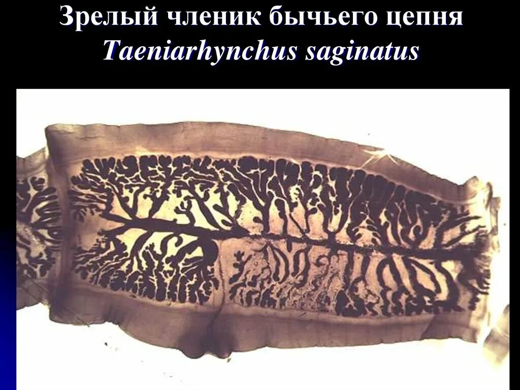 Матка бычьего цепня. Гермафродитный членик бычьего цепня препарат. проглоттиды бычьего цепня. членик бычьего цепня препарат. зрелый членик бычьего цепня микроскоп.