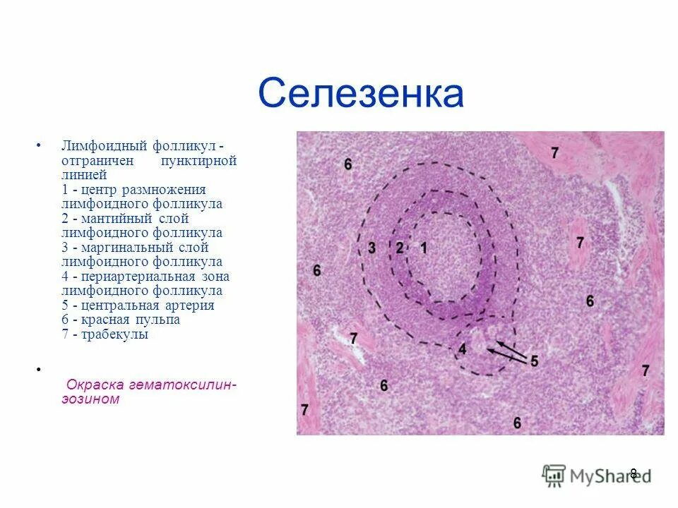 Строение селезенки гистология. Селезенка гистология препарат. Лимфатические фолликулы селезенки. Лимфоидные фолликулы гистология. Лимфоидный фолликул селезенки гистология.