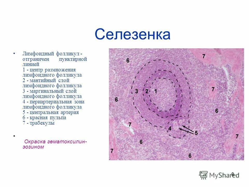 Лимфатический фолликул селезенки гистология. Селезенка гистология препарат. Лимфоидный фолликул селезенки гистология. Строение лимфатического фолликула гистология.