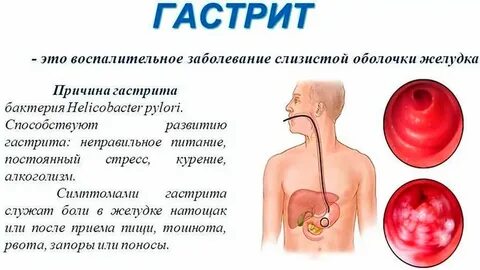 Тошнота после приема еды
