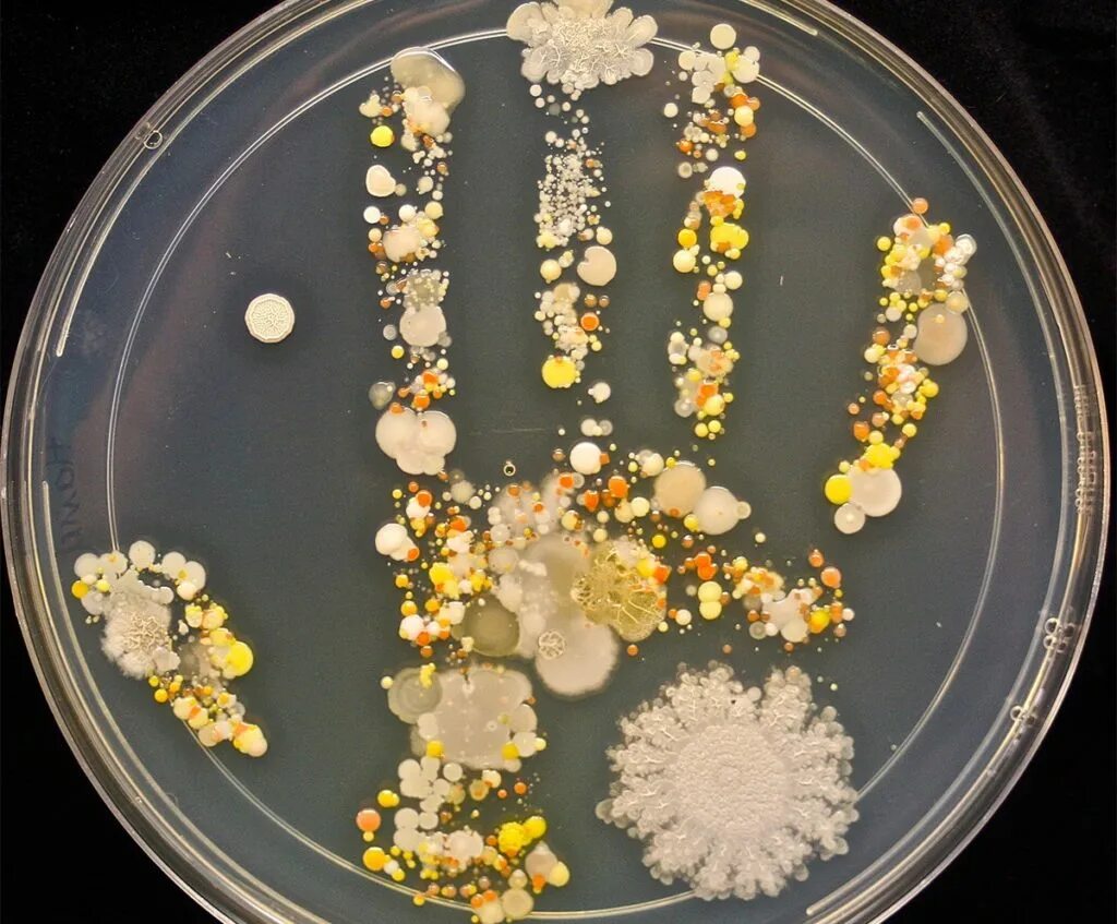 Колонии бактерий в чашке петри. Микробы в чашке петри. Опыты с бактериями для детей. Эксперимент с бактериями. Чашка петри с агаром.
